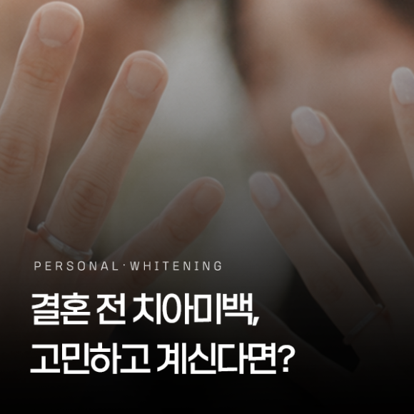 신부 본식 결혼 전 치아미백, 고민하고 계신가요? 적절한 시기는? 관련 이미지 1