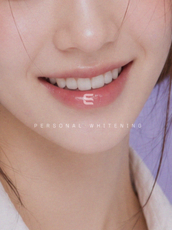 Magok One-Day Tooth Whitening: Is It Possible in Just One Day? image 3