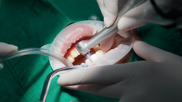 강서구라미네이트 실패하기 싫다면 꼭 읽어봐야 할 글 관련 이미지 2