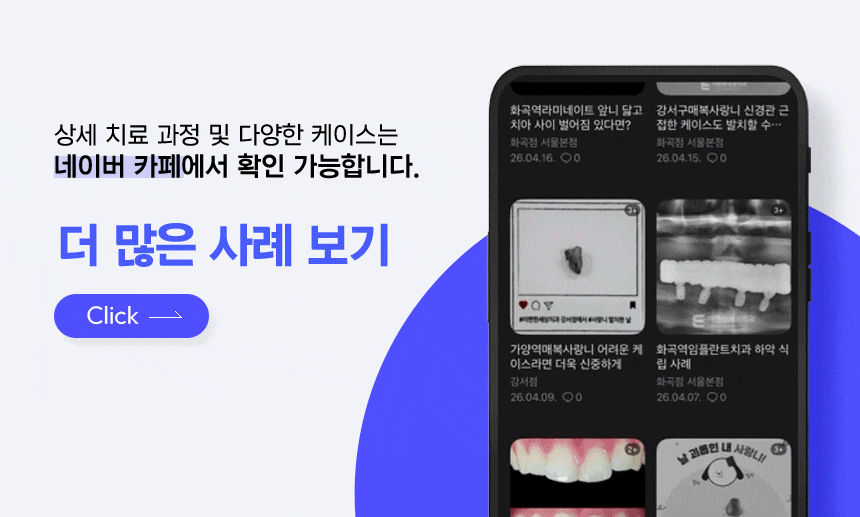 신경치료 후 커피 꼭 마셔야겠다면 온도를 체크하세요. 관련 이미지 5