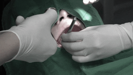 강서구사랑니 전문 치과 찾는 방법 알려드릴게요 관련 이미지 7