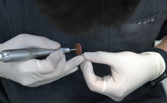 강서구 라미네이트 치과, 시술 전 후회하지 않으려면 꼭 확인하세요 관련 이미지 8