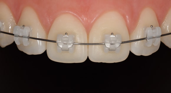 Gangseo Orthodontics: You Should Choose a Place Like This image 4