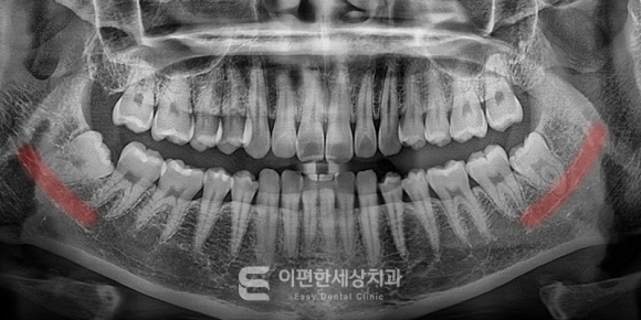 양천향교역치과 찾다가 대학병원 가라는 말을 들으셨다면 관련 이미지 3