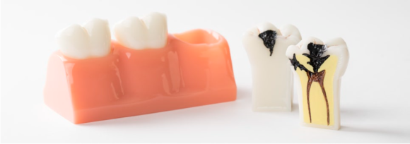 아랫니 시림, 3가지 원인일 확률이 높습니다! 관련 이미지 2