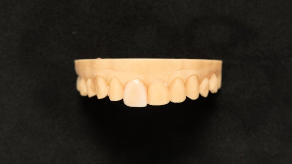 강서구라미네이트 실패하기 싫다면 꼭 읽어봐야 할 글 관련 이미지 3