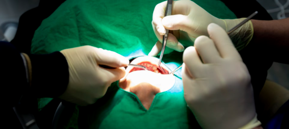 이빨 흔들림? 치주 질환이 원인일 수 있습니다! 관련 이미지 2