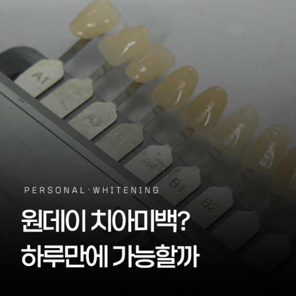 Magok One-Day Tooth Whitening: Is It Possible in Just One Day? image 1