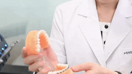 화곡동치아교정 한 번에 성공하고 싶다면 이걸 기억하세요 관련 이미지 6