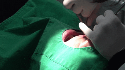 화곡동치아교정 한 번에 성공하고 싶다면 이걸 기억하세요 관련 이미지 7