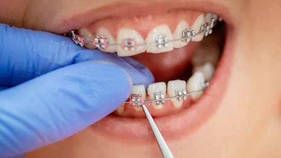 등촌동치아교정 치과 찾고 계시나요? 이것만은 확인해 주세요. 관련 이미지 1