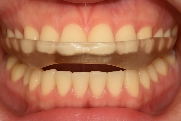 Gangseo-gu Weekend Dental Clinic: Why Is Oral Examination Important? image 5