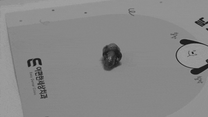 부천매복사랑니 40대보다 20대 때 뽑는 것이 좋은 이유 관련 이미지 1