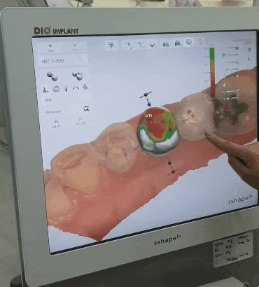 이제 원내 기공소 없이 보철물 못 만듭니다. 관련 이미지 3