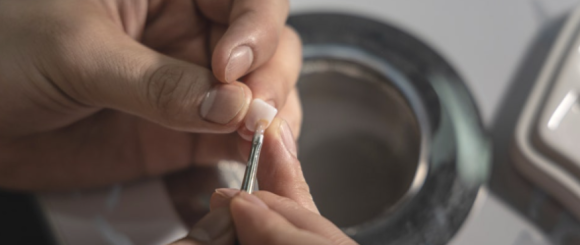 강서구 라미네이트 치과, 시술 전 후회하지 않으려면 꼭 확인하세요 관련 이미지 9