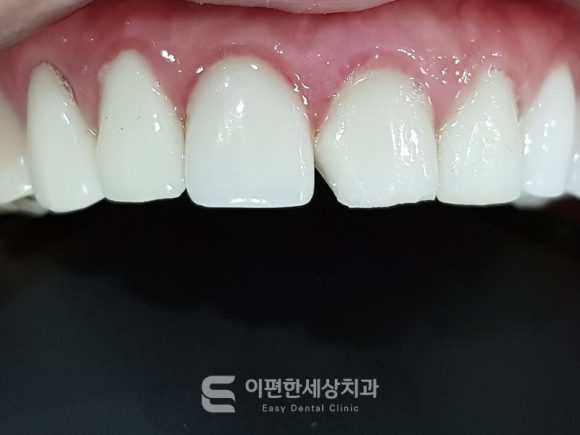 강서구화곡동라미네이트, 꼭 살펴봐야 할 부분은? 관련 이미지 6