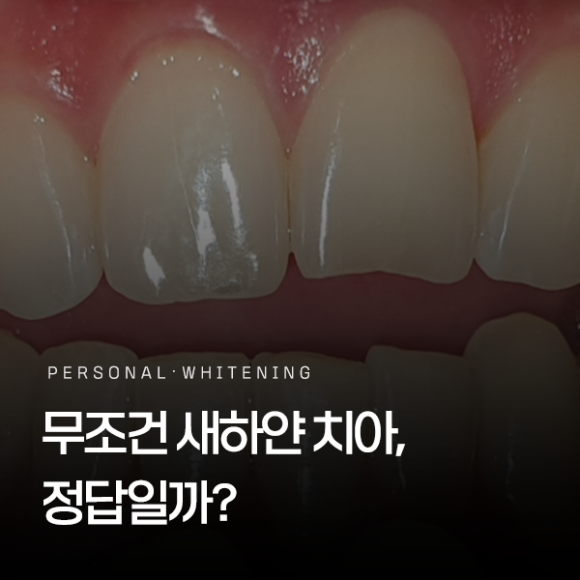 강서구치아미백, 무조건 새하얀 치아가 정답일까? 관련 이미지 1