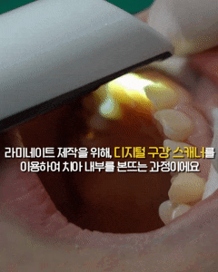 What to Consider When Choosing a Laminate Dentistry Clinic in Hwagok, Seoul image 4