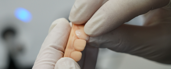 Can Yellowish Canines Be Improved with Teeth Whitening? image 6
