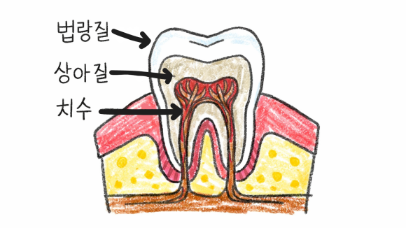 이가 시린 이유 그냥 두면 절대 안 됩니다 관련 이미지 1