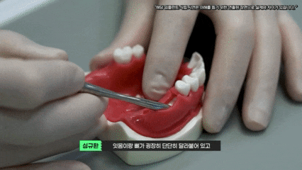 화곡역임플란트치과 선택이 고민이시라면 읽어보세요 관련 이미지 5