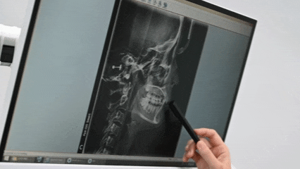 화곡역교정치과 선택에 도움이 되는 글 관련 이미지 3