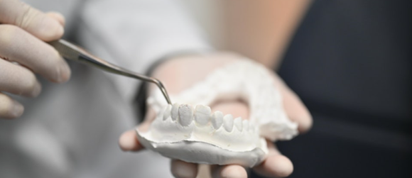 치아교정 치과, 고민된다면 읽어보세요. 관련 이미지 9