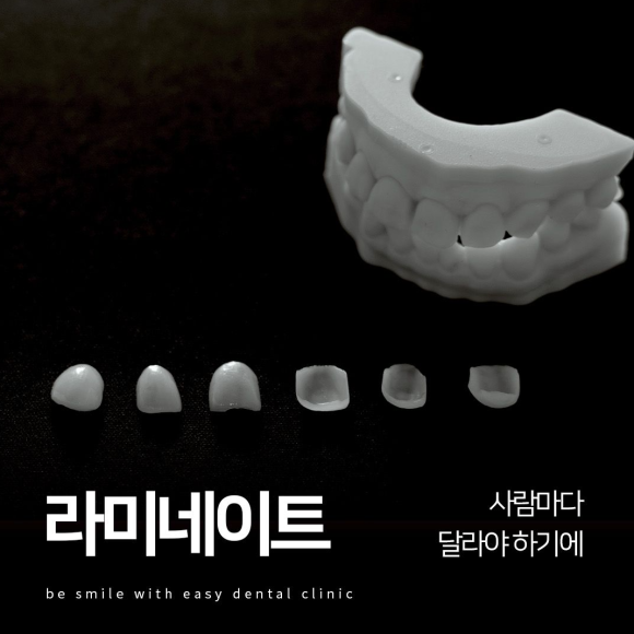 강서구 라미네이트 치과, 시술 전 후회하지 않으려면 꼭 확인하세요 관련 이미지 6
