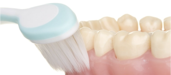 임플란트 워터픽 하면 이 점이 좋습니다. 관련 이미지 1