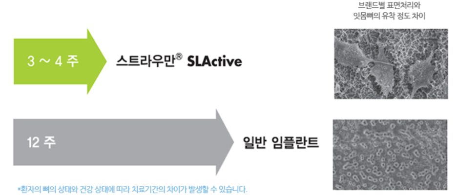 강서구 스트라우만 임플란트 환자분들이 선호하는 이유 관련 이미지 10