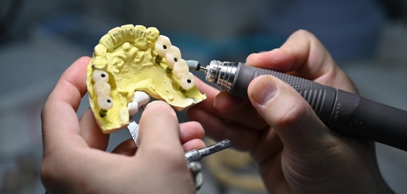 How Should You Choose a Gangseo Implant Dental Clinic? image 7