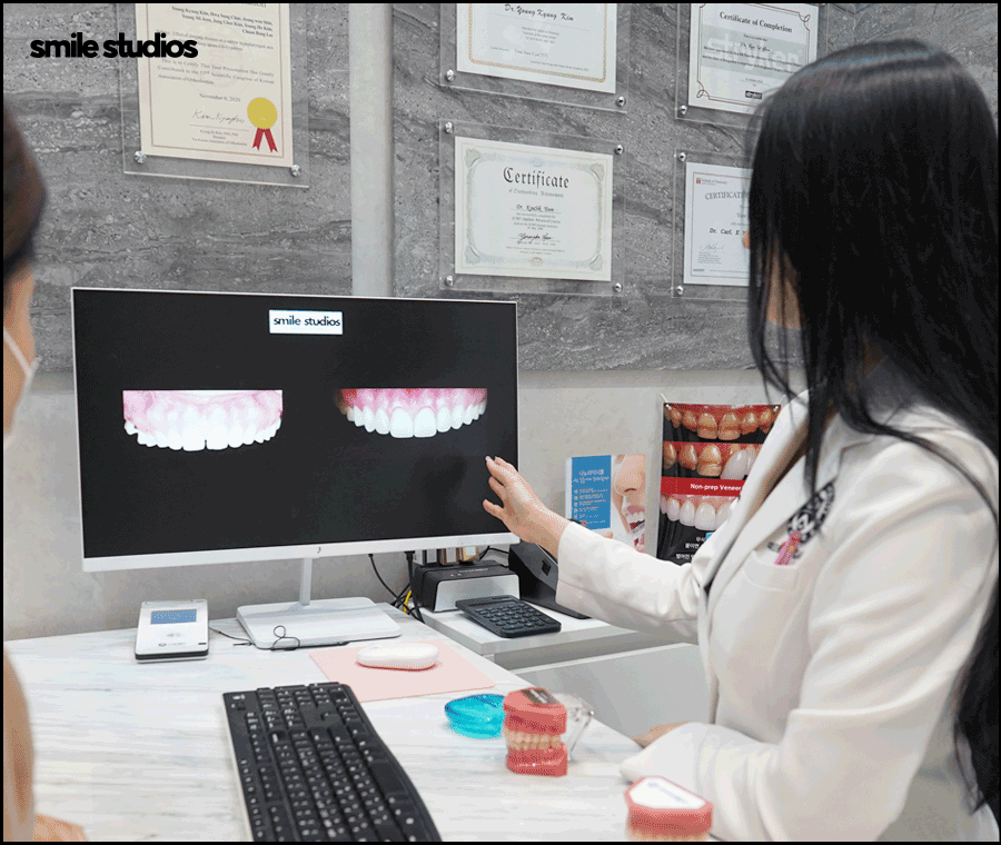 라미네이트제거 시기 및 유지력, 알아둘 사항 관련 이미지 11