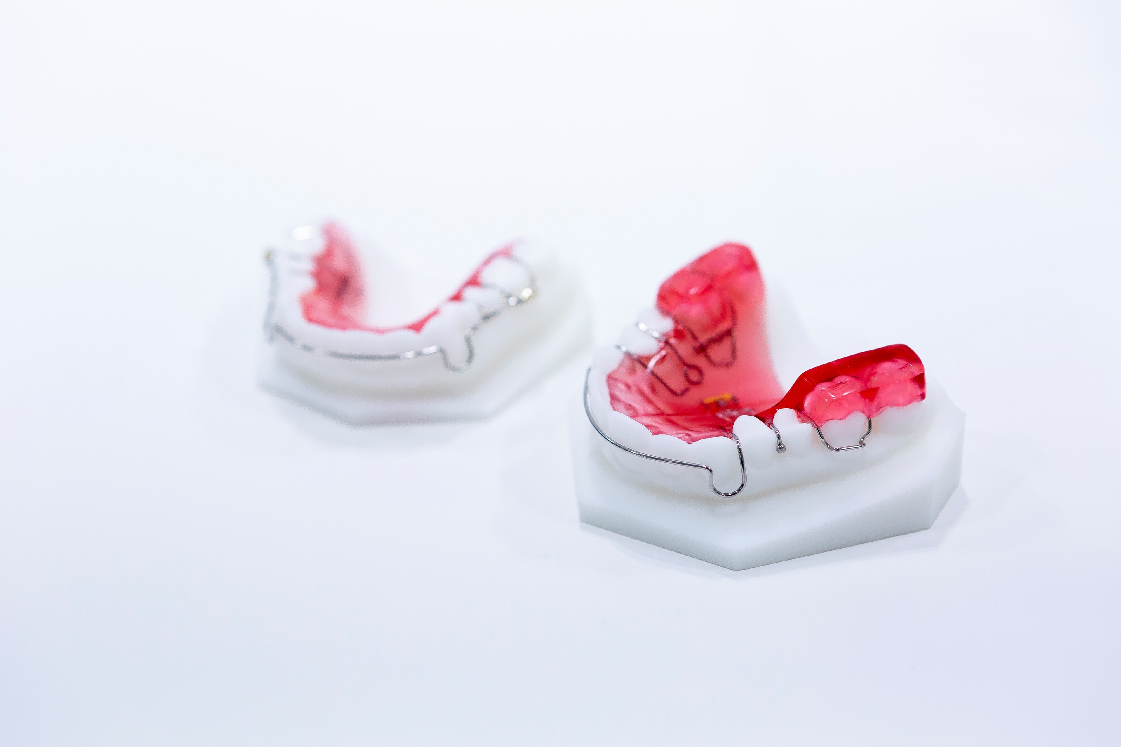 치아교정 종류, 나에게 맞는 교정법은? 관련 이미지 2