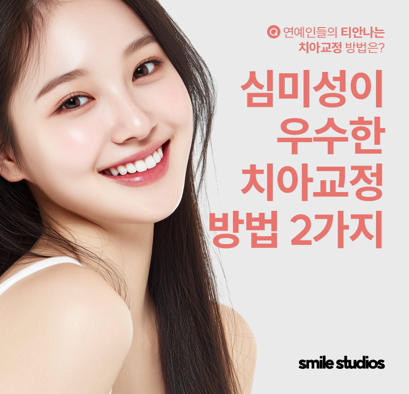 연예인 치아교정 심미성이 우수한 방법 2가지 관련 이미지 1