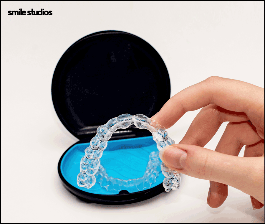 서울인비절라인 권장 케이스, 장점, 치료 시간 정리 관련 이미지 6