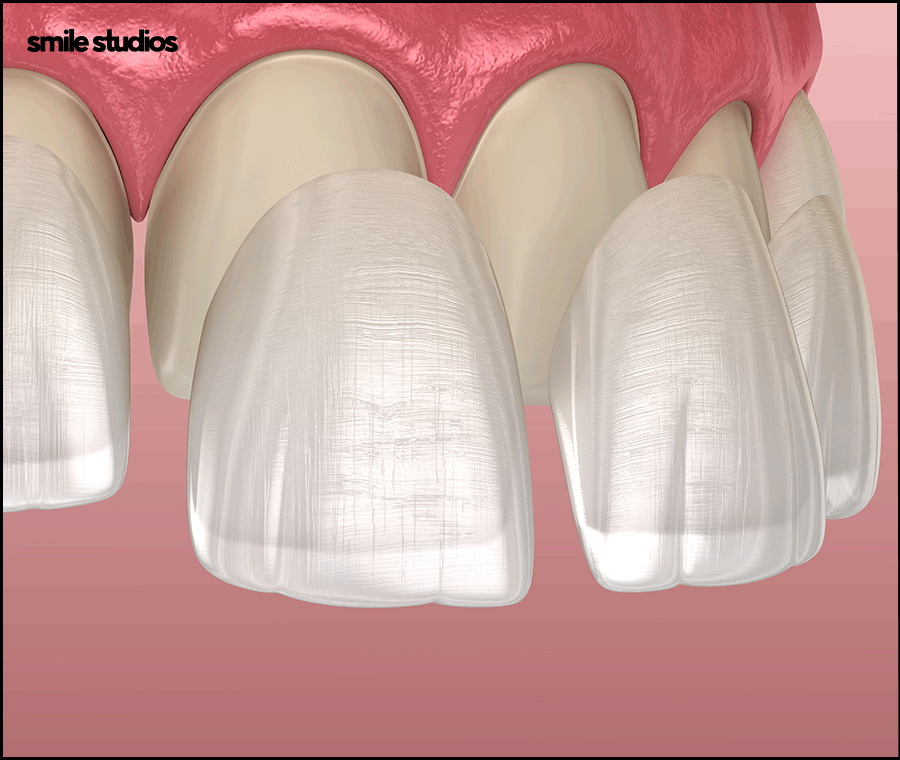 A Complete Guide to Laminate Replacement Timing, Lifespan, and Precautions image 3