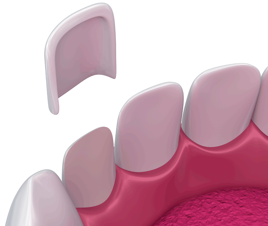 라미네이트가격 및 달라지는 기준, 확인하기 관련 이미지 6