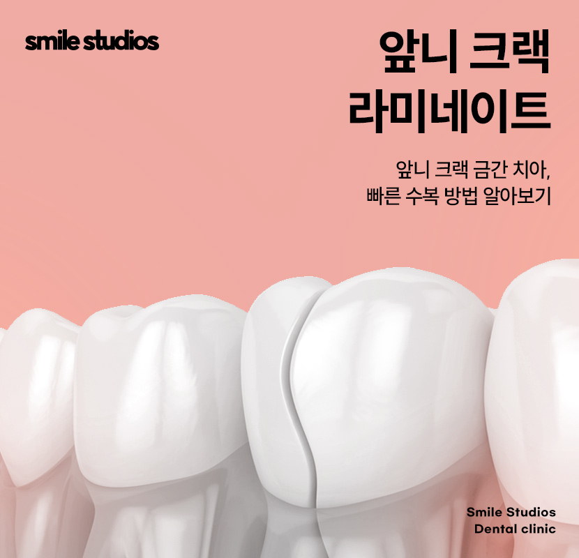 앞니 크랙 금간 치아, 빠른 수복 방법 알아보기 관련 이미지 1