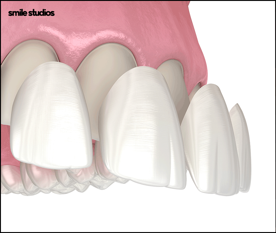 라미네이트 코팅이란? 원리와 기대 효과, 추천 대상 관련 이미지 5