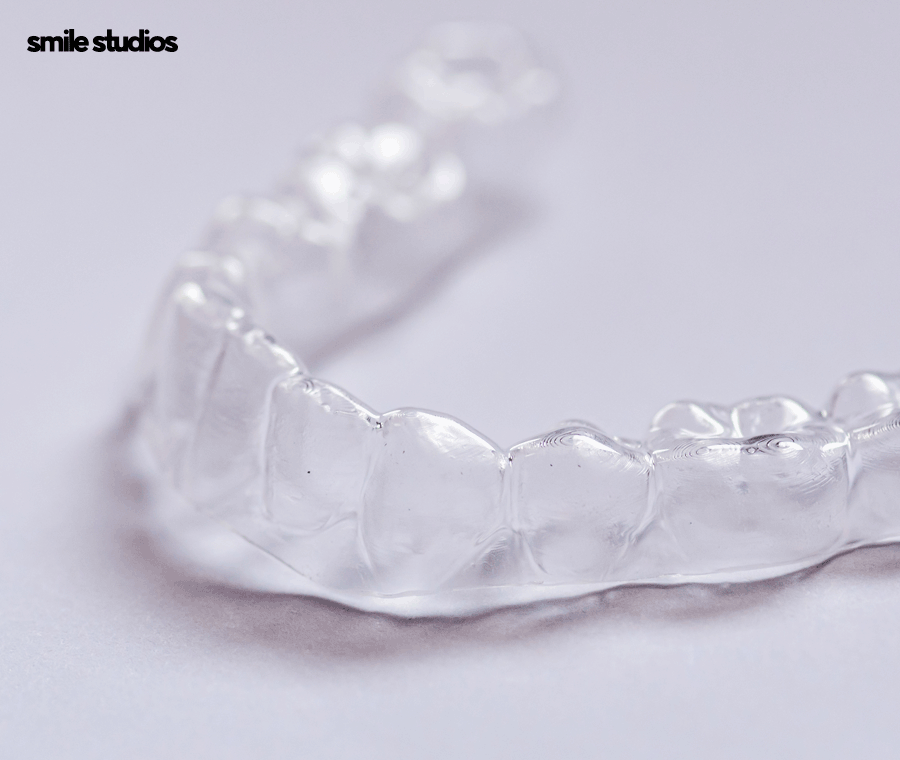 강남역 교정치과 삐뚠 앞니, 부분 치료 괜찮을까? 관련 이미지 6