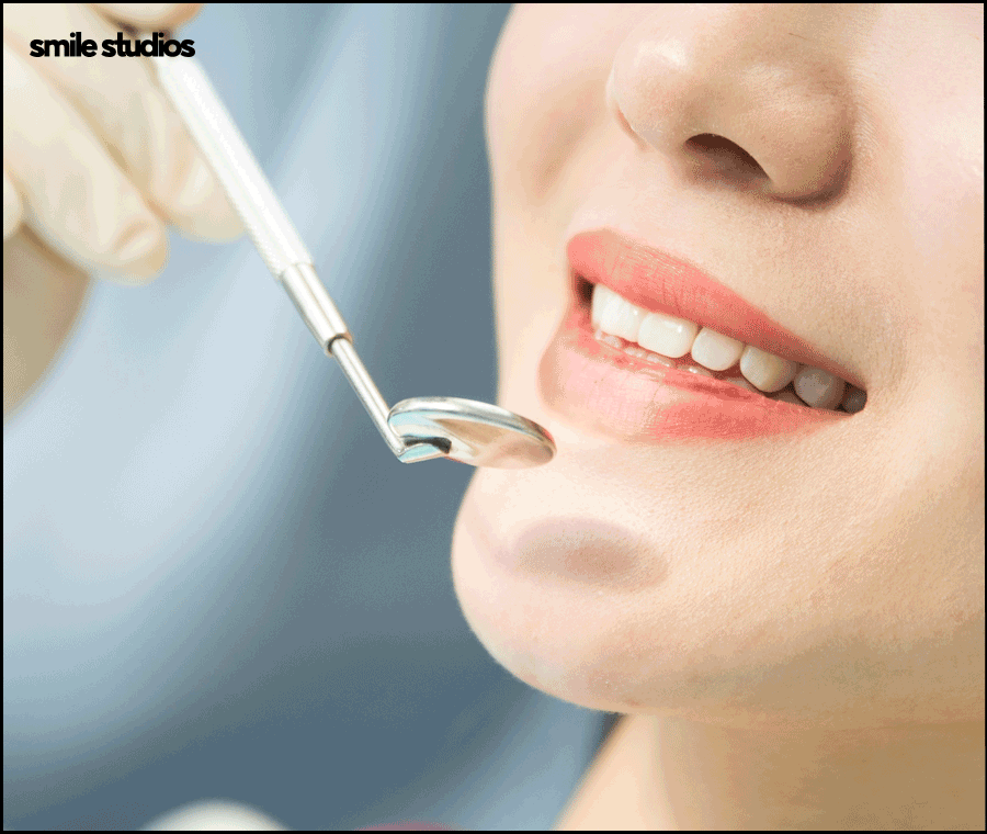 논현역 치과 라미네이트 시술 전 필수 확인 사항 관련 이미지 5