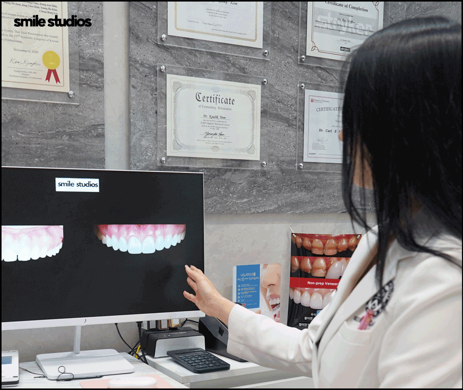 김영경 원장이 전하는 무삭제 라미네이트 A to Z 관련 이미지 3