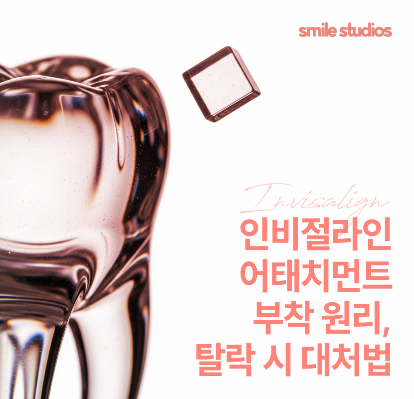 인비절라인 어태치먼트 부착 원리, 탈락 시 대처법 관련 이미지 1