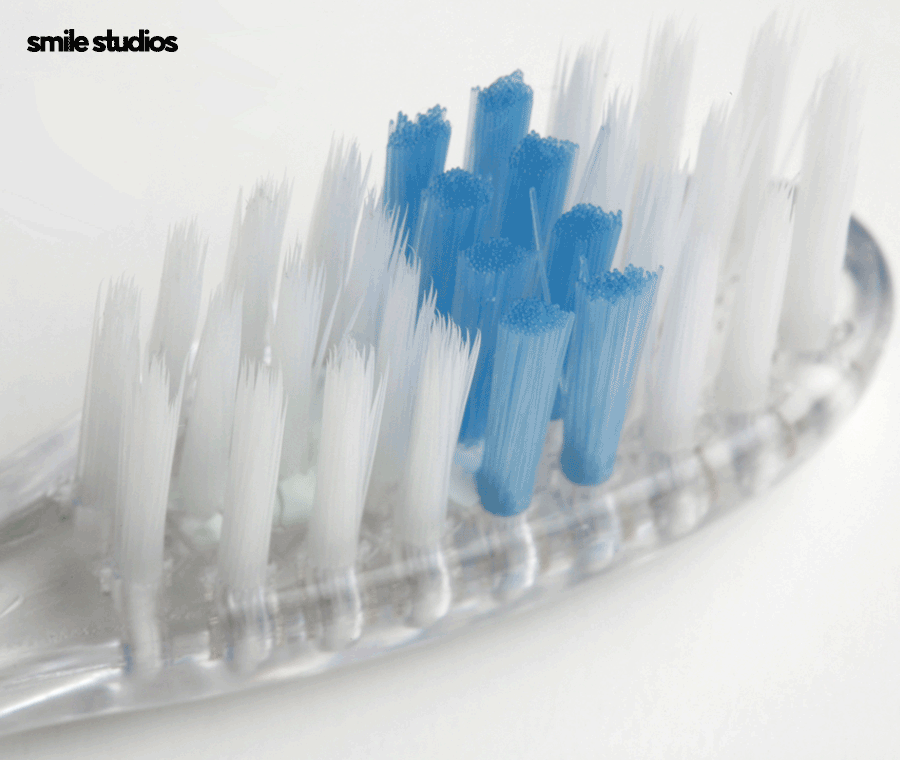 투명 교정기 세척 올바른 관리 방법 A to Z 관련 이미지 5