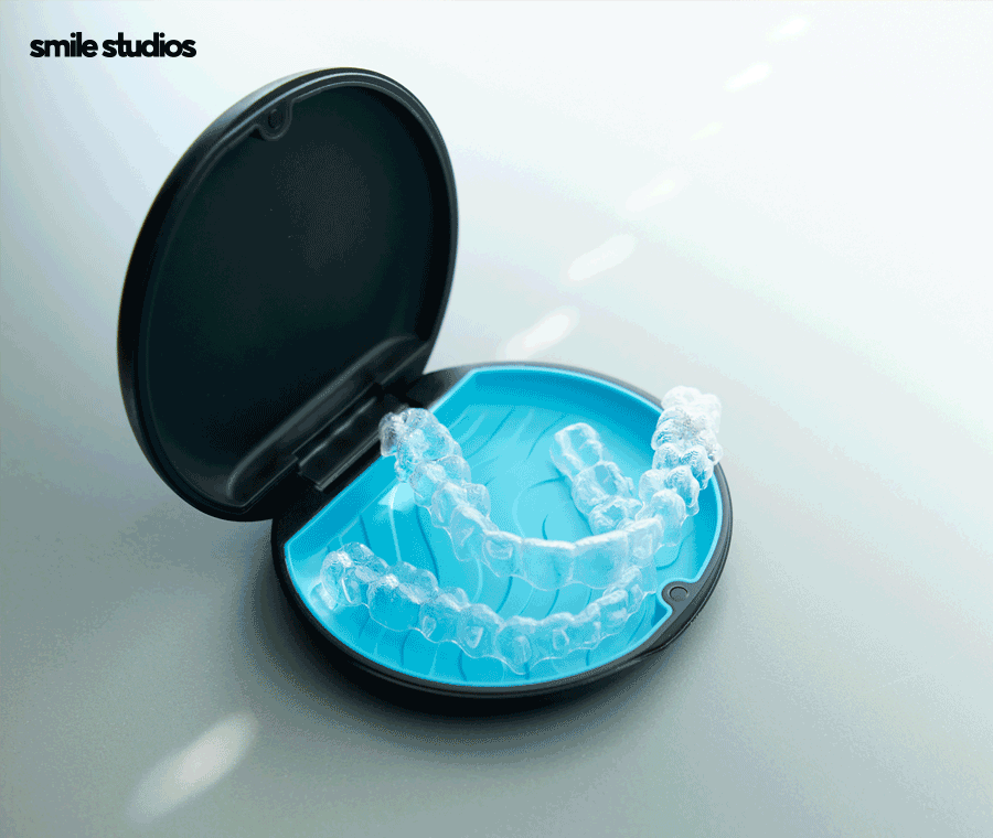 부정교합 치아교정 비용 다른 이유, 함께 체크할 사항 관련 이미지 5