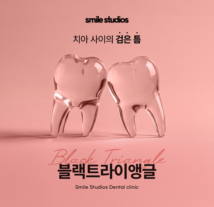 블랙트라이앵글 치료 적합한 방법 알아보기 관련 이미지 1