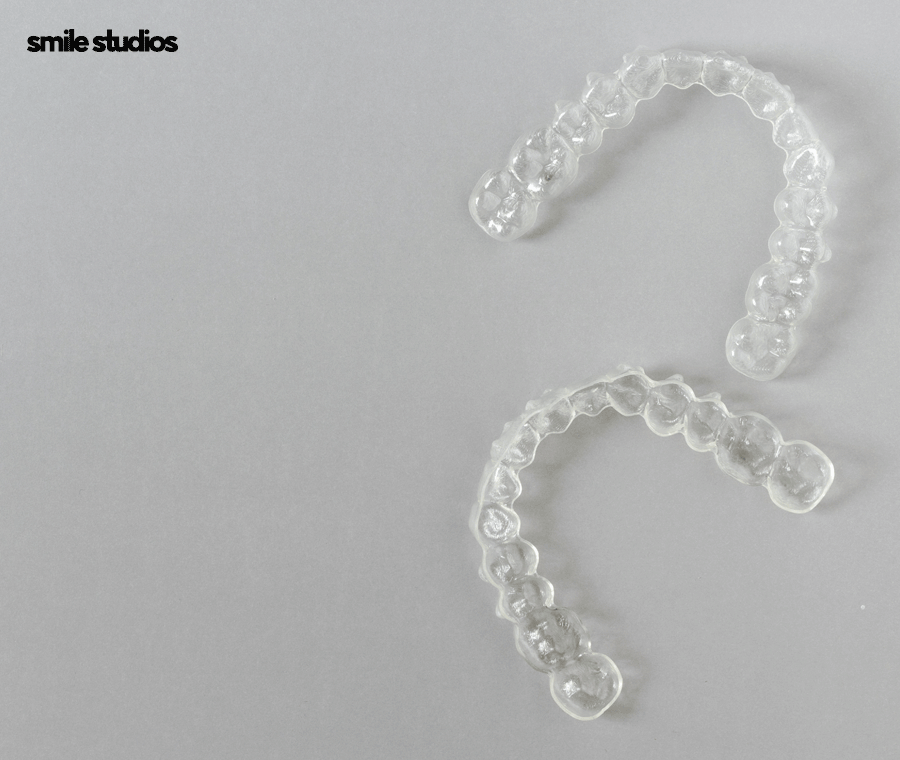 돌출입교정가격 기준 및 효과, 방법 파헤치기 관련 이미지 6