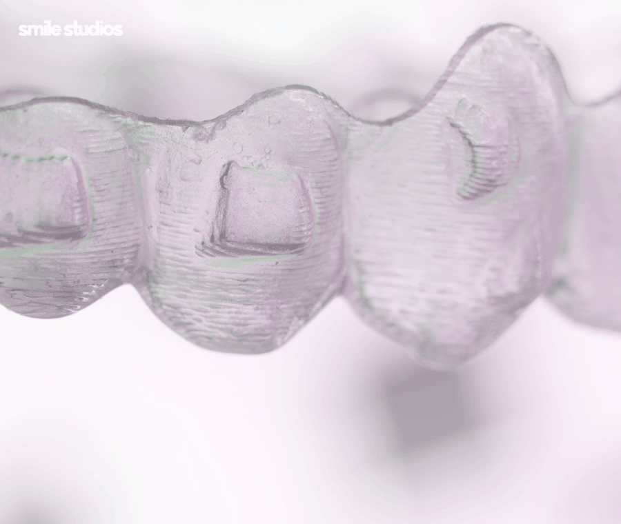 강남 논현 치과 투명 치아교정 시작 전 확인사항 관련 이미지 4