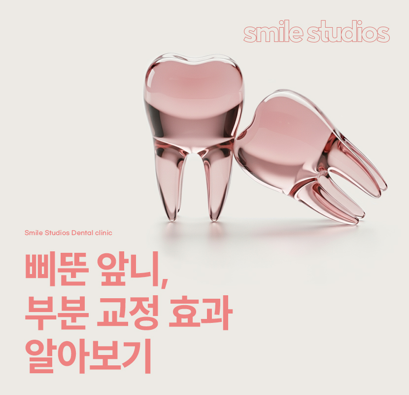 강남역 교정치과 삐뚠 앞니, 부분 치료 괜찮을까? 관련 이미지 1