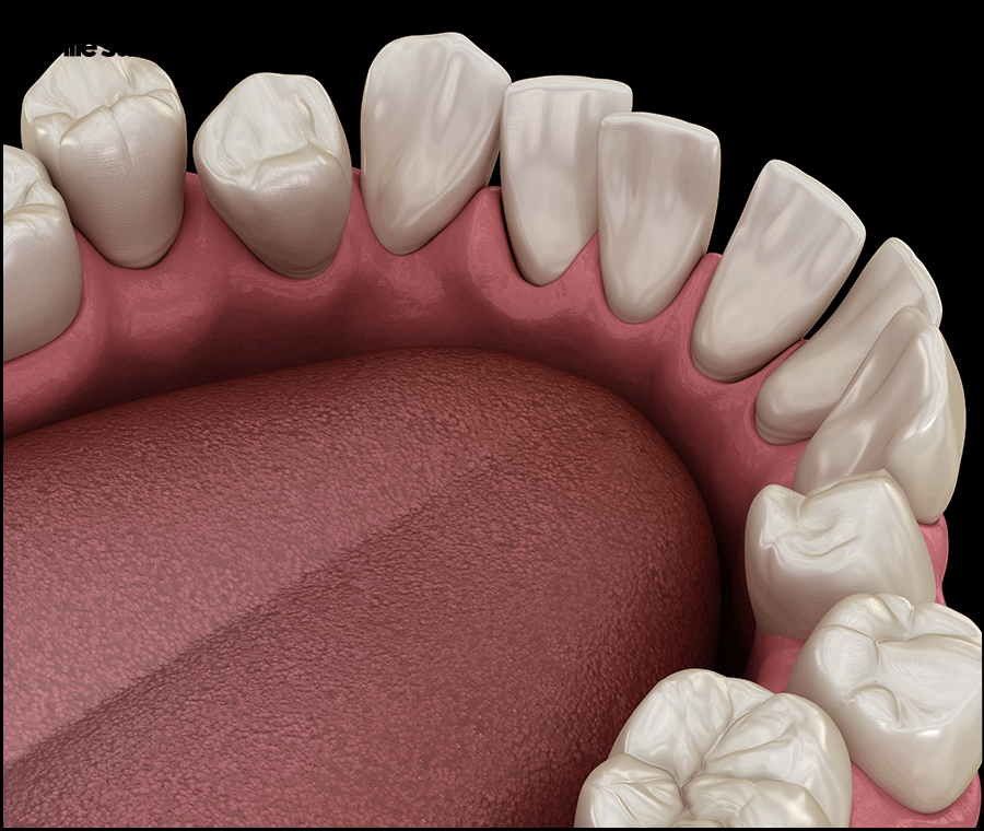 강남교정치과 선택 전 꼭 체크해야 하는 3가지 관련 이미지 4